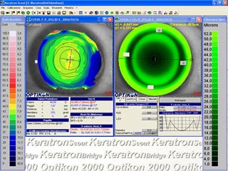 Programma computerizzato per lenti CRT